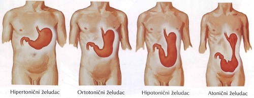 Slika